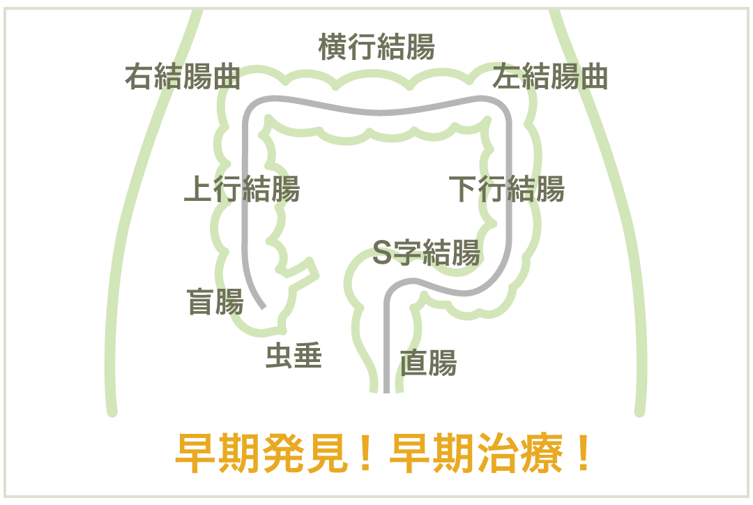 大腸内視鏡検査